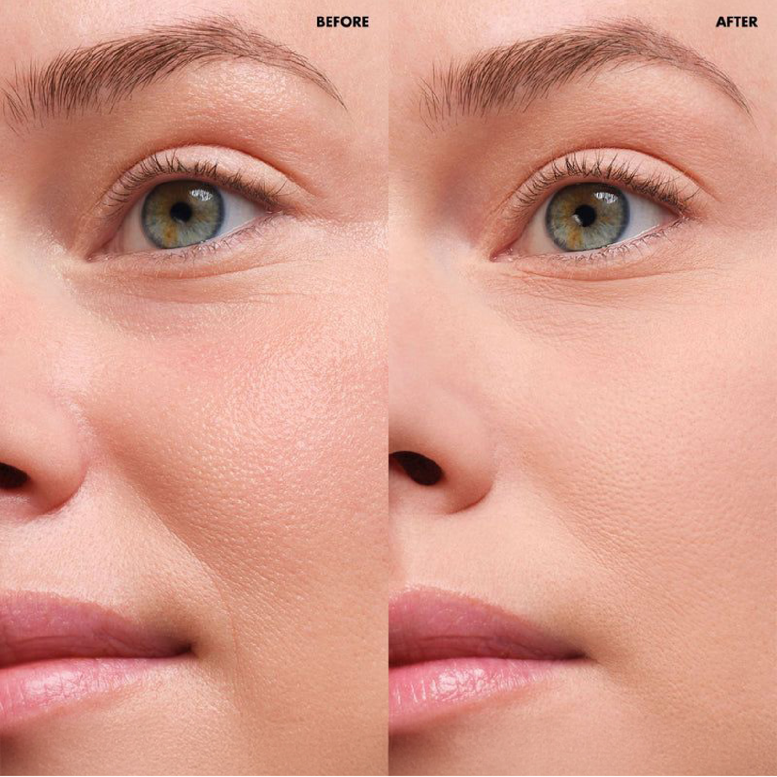 MATTIFYING PORELESS - Imagen 2